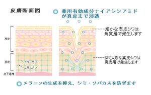 皮膚断面図